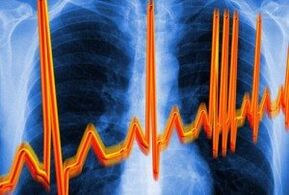 Ritmia cardiaca contro l'osteocondosi