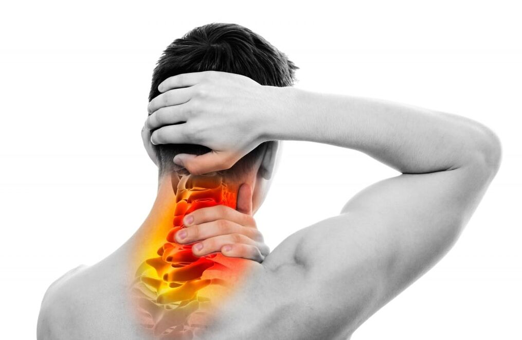 Sintomi dell'osteocondrosi cervicale
