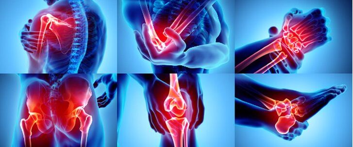 Articolazioni infiammate